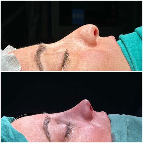 dr taylan's clinic photos|Watch this story by Op. Dr. Taylan ÇİL on Instagram before it .